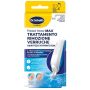 Trattamento rimozione verruche scholl freeze away max